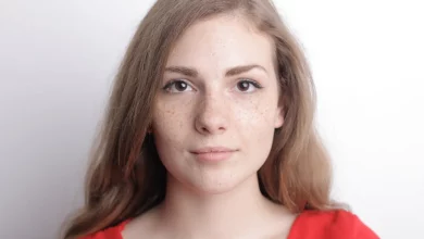 Девушка с пигментными пятнами