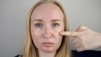 Дівчина демонструє жирну шкіру