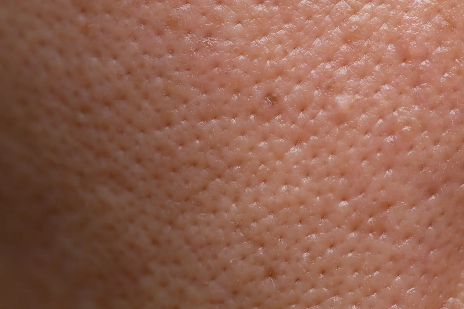 Поры