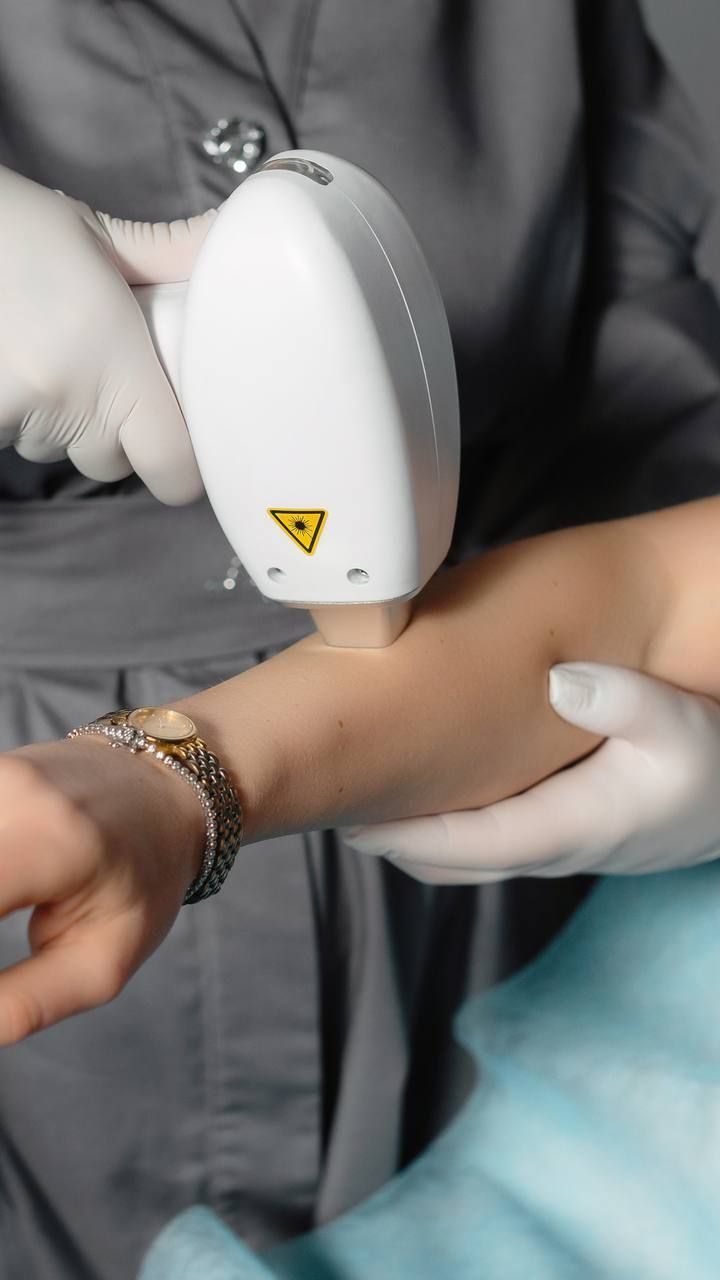 5 поширених помилок після лазерної епіляції, яких легко уникнути