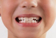 +nxBvIAAAAAXRSTlMAQObYZgAAABZJREFUOI1jYMADmEe5o9xR7iiXQi4A4BsA388WUyMAAAAASUVORK5CYII=